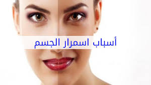 أسباب اسمرار الجسم