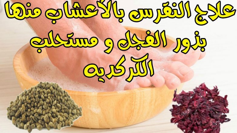 علاج النقرس بالاعشاب