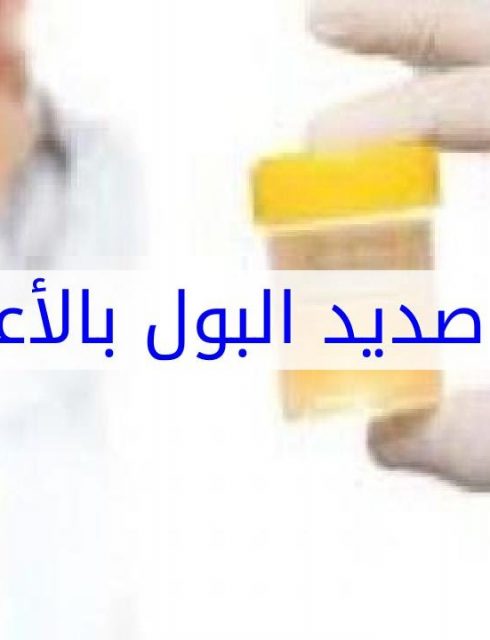 علاج صديد البول بالأعشاب