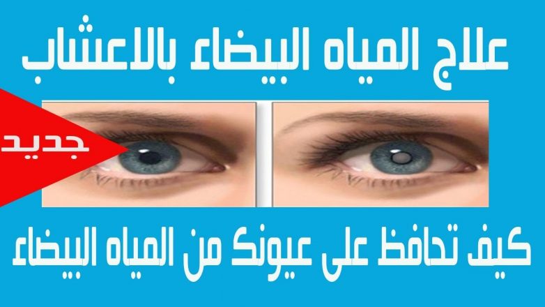 علاج المياه البيضاء بالأعشاب